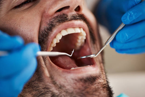 Best Emergency Treatment for Dental Infections or Abscesses in Isanti, MN
